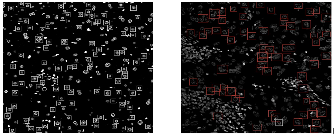 Maker Faire | Machine-Learning (ML) Detection of Cancerous Cells ...